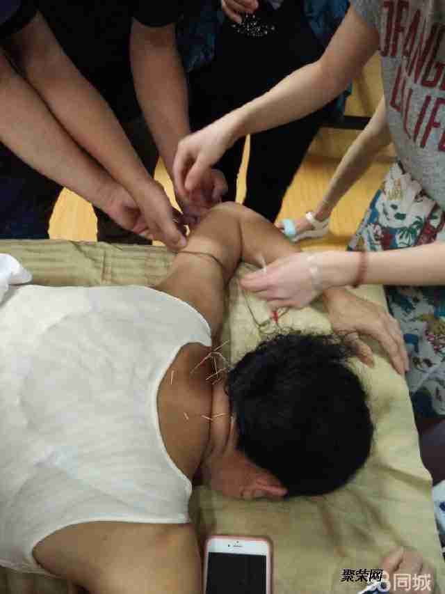 針灸教學(xué)視頻140集免費針灸教學(xué)視頻140集免費百度云